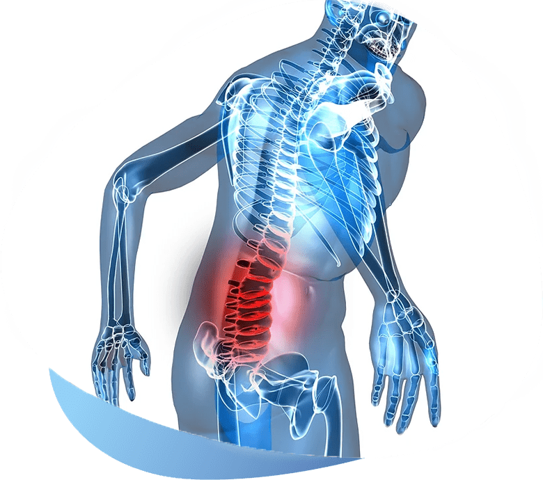 Neuropathic Pain Treamtment in Inidana