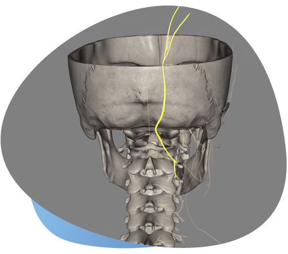 Occipital Nerve Block in Indiana